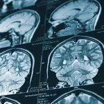 Your Aging Brain Isn’t Just Declining. Scientists Say Forgetting Details May Give It a Different Advantage