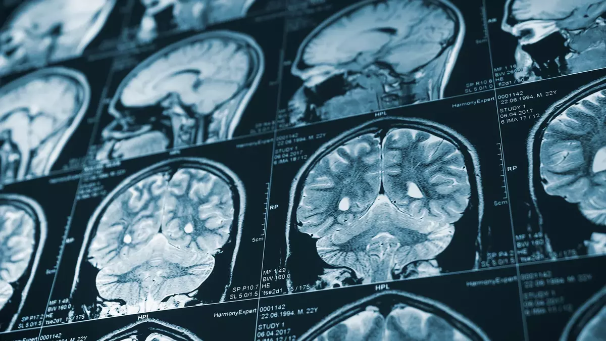 Your Aging Brain Isn’t Just Declining. Scientists Say Forgetting Details May Give It a Different Advantage