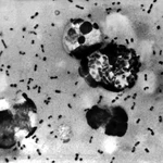 
				Suspected Plague Death at Russian Lab Sparks 'Anti-Epidemic' Lockdown
			
