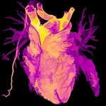Old hearts age backwards: transplanted organs adjust to host’s biological age