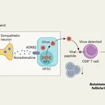 Nerve activity initiates autoimmune hair loss
