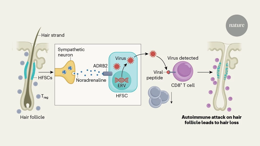 Nerve activity initiates autoimmune hair loss