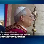 Pope Leo says he will undergo surgery for small growth on lung