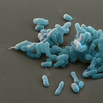 Plague scare: what scientists know — and what Russia won’t say