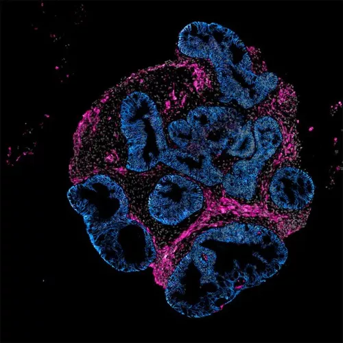 Mini Human Intestines: Intero Biosystems’ Animal Testing Alternative